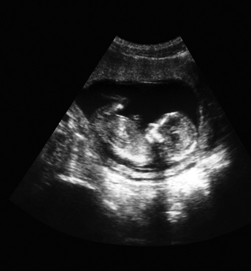 an ultrasound image